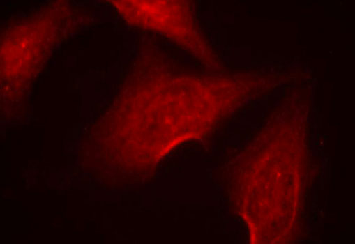 Immunocytochemistry/ Immunofluorescence - Anti-NF-kB p65 (phospho S311) antibody (AB194926), expandable thumbnail