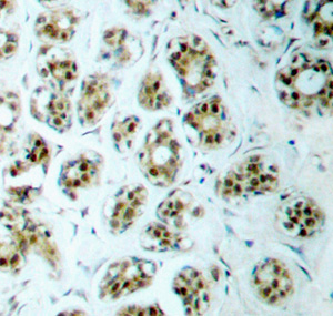 Immunohistochemistry (Formalin/PFA-fixed paraffin-embedded sections) - Anti-NF-kB p65 (phospho S311) antibody (AB194926), expandable thumbnail