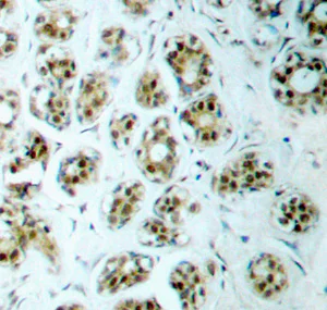 Immunohistochemistry (Formalin/PFA-fixed paraffin-embedded sections) - Anti-NF-kB p65 (phospho S311) antibody (AB194926)