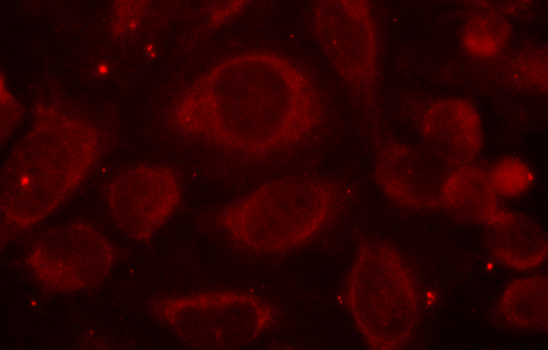 Immunocytochemistry/ Immunofluorescence - Anti-NF-kB p65 (phospho S468) antibody (AB194921), expandable thumbnail