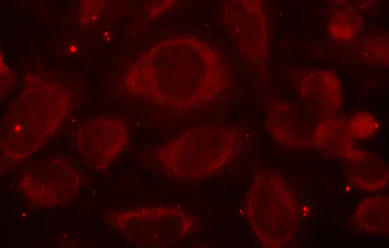 Immunocytochemistry/ Immunofluorescence - Anti-NF-kB p65 (phospho S468) antibody (AB194921)