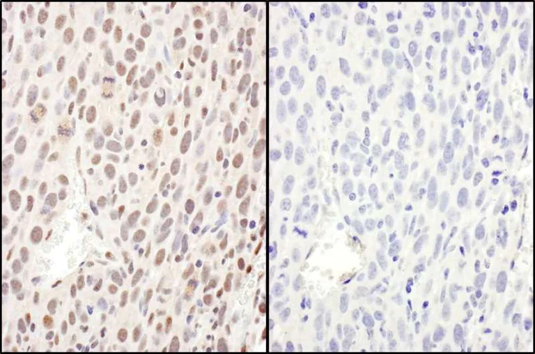 Immunohistochemistry (Formalin/PFA-fixed paraffin-embedded sections) - Anti-NF-kB p65 (phospho S468) antibody (AB264271)