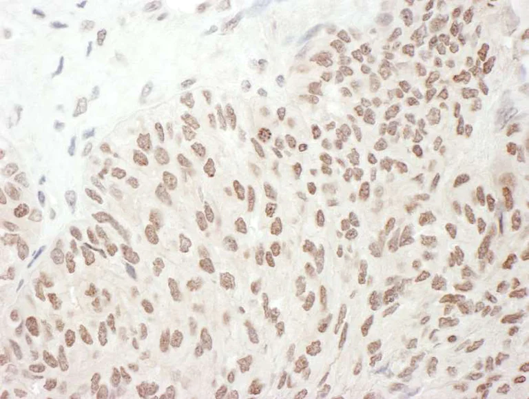 Immunohistochemistry (Formalin/PFA-fixed paraffin-embedded sections) - Anti-NF-kB p65 (phospho S468) antibody (AB264271)