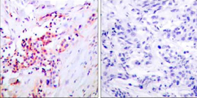 Immunohistochemistry (Formalin/PFA-fixed paraffin-embedded sections) - Anti-NF-kB p65 (phospho S468) antibody (AB31473)