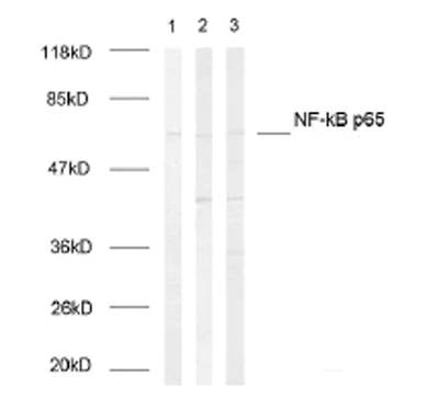 Western blot - Anti-NF-kB p65 (phospho S468) antibody (AB31473)