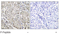 Immunohistochemistry (Formalin/PFA-fixed paraffin-embedded sections) - Anti-NF-kB p65 (phospho S529) antibody (AB97726)