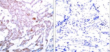 Immunohistochemistry (Formalin/PFA-fixed paraffin-embedded sections) - Anti-NF-kB p65 (phospho S536) antibody (AB28856), expandable thumbnail