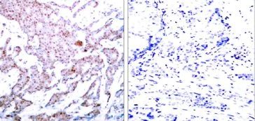 Immunohistochemistry (Formalin/PFA-fixed paraffin-embedded sections) - Anti-NF-kB p65 (phospho S536) antibody (AB28856)