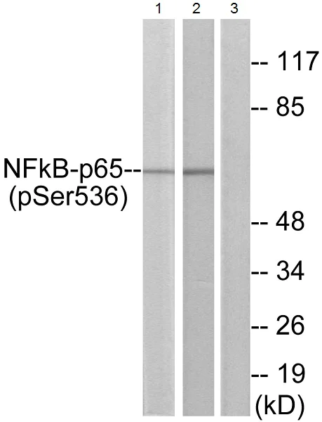 Western blot - Anti-NF-kB p65 (phospho S536) antibody (AB28856)