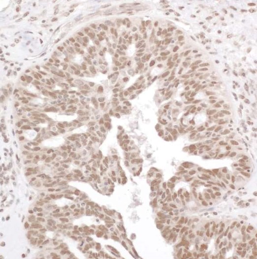 Immunohistochemistry (Formalin/PFA-fixed paraffin-embedded sections) - Anti-NF-kB p65 (phospho S536) antibody (AB86299), expandable thumbnail