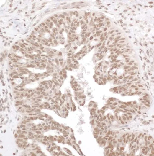 Immunohistochemistry (Formalin/PFA-fixed paraffin-embedded sections) - Anti-NF-kB p65 (phospho S536) antibody (AB86299)