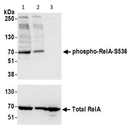 Western blot - Anti-NF-kB p65 (phospho S536) antibody (AB86299), expandable thumbnail