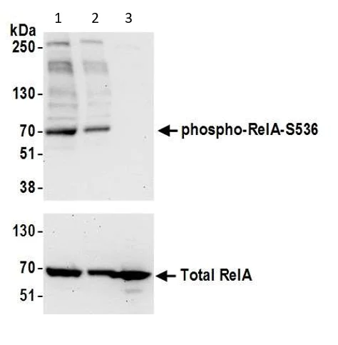 Western blot - Anti-NF-kB p65 (phospho S536) antibody (AB86299)