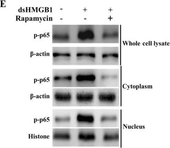 Western blot - Anti-NF-kB p65 (phospho S536) antibody (AB86299)