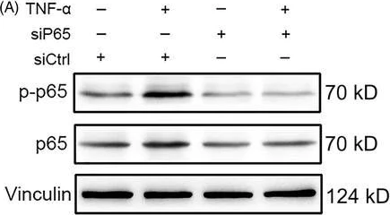 Western blot - Anti-NF-kB p65 (phospho S536) antibody (AB86299)