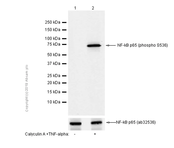 Western blot - Anti-NF-kB p65 (phospho S536) antibody [EP2294Y] - BSA and Azide free (AB239882)