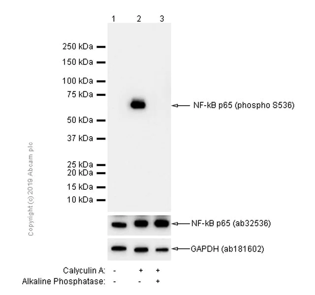 Western blot - Anti-NF-kB p65 (phospho S536) antibody [EP2294Y] - BSA and Azide free (AB239882)