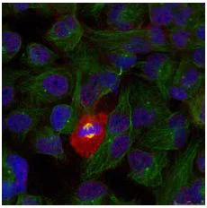 Immunocytochemistry/ Immunofluorescence - Anti-NF-kB p65 (phospho T254) antibody (AB131100)