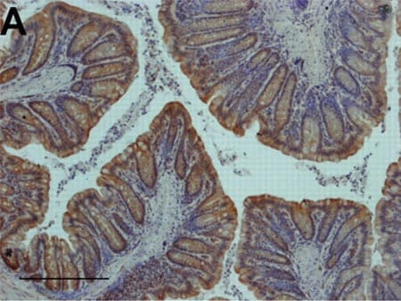 Immunohistochemistry (Formalin/PFA-fixed paraffin-embedded sections) - NF-kB Signaling Pathway Antibody Sampler Panel (AB228529), expandable thumbnail