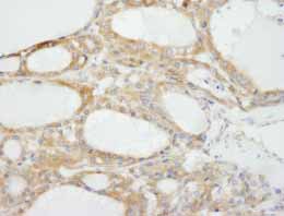 Immunohistochemistry (Formalin/PFA-fixed paraffin-embedded sections) - Anti-NF2 / Merlin antibody (AB84550)