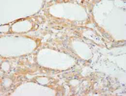 Immunohistochemistry (Formalin/PFA-fixed paraffin-embedded sections) - Anti-NF2 / Merlin antibody (AB84550)