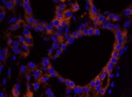 Immunohistochemistry (Formalin/PFA-fixed paraffin-embedded sections) - Anti-NF2 / Merlin antibody (AB84550)