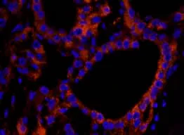 Immunohistochemistry (Formalin/PFA-fixed paraffin-embedded sections) - Anti-NF2 / Merlin antibody (AB84550)