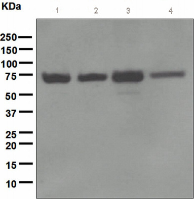 Western blot - Anti-NF2 / Merlin antibody [EPR2573(2)] (AB109244)