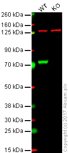 Western blot - Anti-NF2 / Merlin antibody [EPR2573(2)] (AB109244)