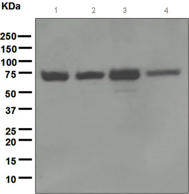 Western blot - Anti-NF2 / Merlin antibody [EPR2573(2)] - BSA and Azide free (AB247805)