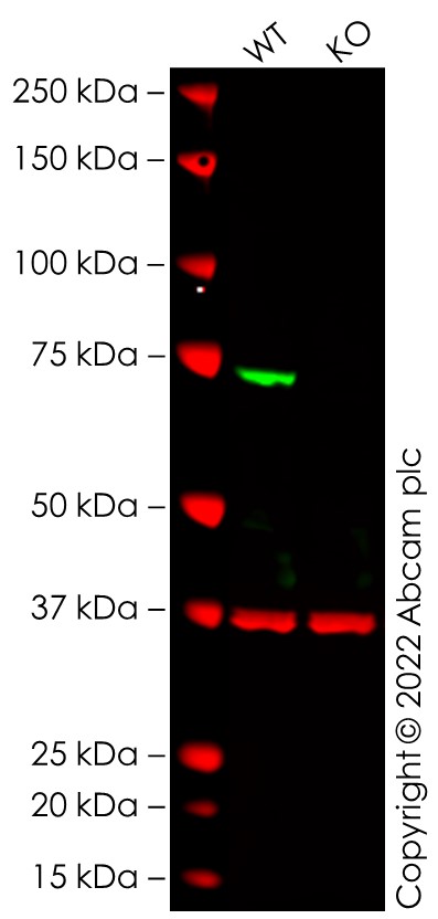 Western blot - Anti-NF2 / Merlin antibody [EPR2573(2)] - BSA and Azide free (AB247805), expandable thumbnail