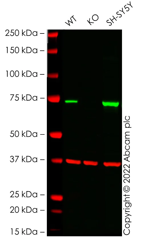 Western blot - Anti-NF2 / Merlin antibody [EPR2573(2)] - BSA and Azide free (AB247805)