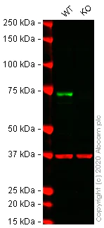 Western blot - Anti-NF2 / Merlin antibody [EPR2573(2)] - BSA and Azide free (AB247805)