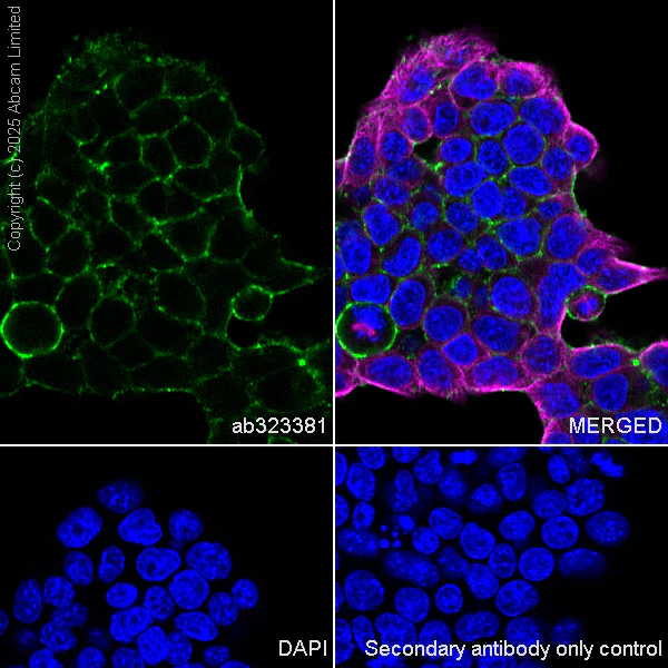 Immunocytochemistry/ Immunofluorescence - Anti-NF2 / Merlin antibody [EPR29635-522] (AB323381)