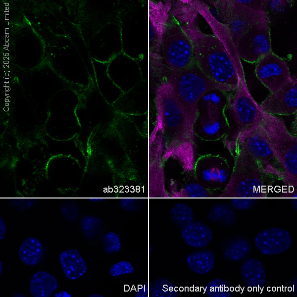 Immunocytochemistry/ Immunofluorescence - Anti-NF2 / Merlin antibody [EPR29635-522] (AB323381)