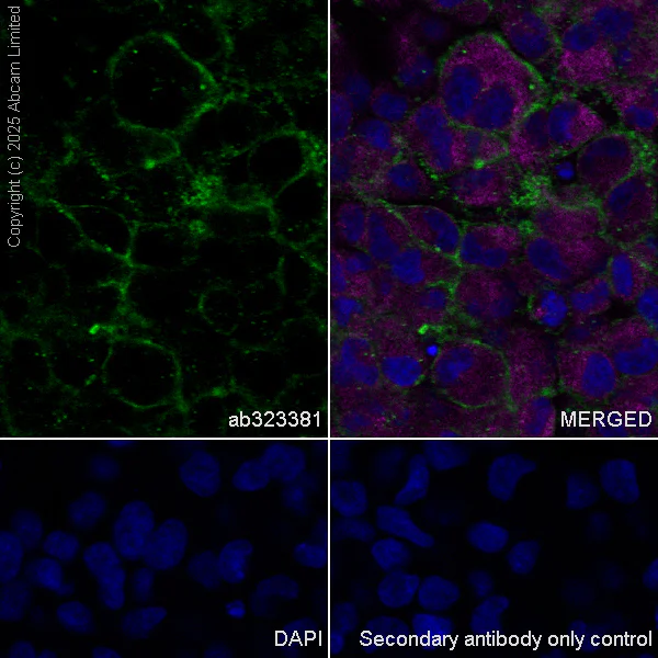 Immunocytochemistry/ Immunofluorescence - Anti-NF2 / Merlin antibody [EPR29635-522] (AB323381)