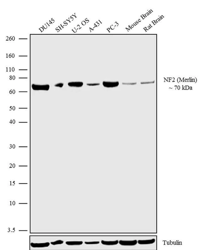 Western blot - Anti-NF2 / Merlin antibody [RP23040199] (AB308025)