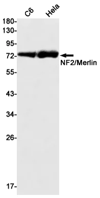 Western blot - Anti-NF2 / Merlin Antibody [S07-1A6] (AB317394)