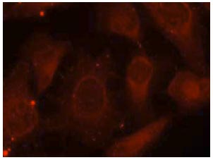 Immunocytochemistry/ Immunofluorescence - Anti-NF2 / Merlin (phospho S518) antibody (AB131473)