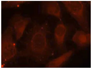 Immunocytochemistry/ Immunofluorescence - Anti-NF2 / Merlin (phospho S518) antibody (AB131473)