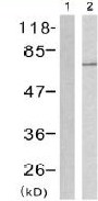 Western blot - Anti-NF2 / Merlin (phospho S518) antibody (AB131473)