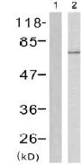Western blot - Anti-NF2 / Merlin (phospho S518) antibody (AB131473)