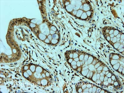Immunohistochemistry (Formalin/PFA-fixed paraffin-embedded sections) - Anti-NF2 / Merlin (phospho S518) antibody (AB2478)