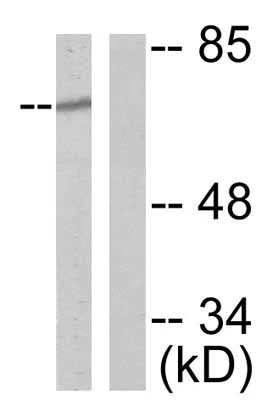 Western blot - Anti-NF2 / Merlin (phospho S518) antibody (AB47378)