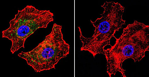 Immunocytochemistry/ Immunofluorescence - Anti-NFAT1 antibody [25A10.D6.D2] (AB2722)