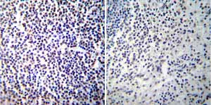 Immunohistochemistry (Formalin/PFA-fixed paraffin-embedded sections) - Anti-NFAT1 antibody [25A10.D6.D2] (AB2722)