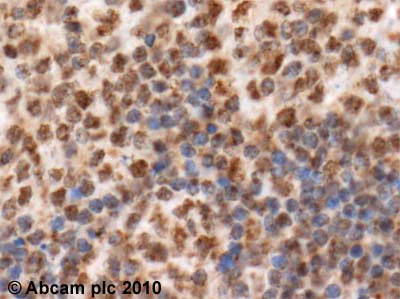 Immunohistochemistry (Formalin/PFA-fixed paraffin-embedded sections) - Anti-NFAT1 antibody [25A10.D6.D2] (AB2722)
