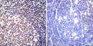Immunohistochemistry (Formalin/PFA-fixed paraffin-embedded sections) - Anti-NFAT1 antibody [25A10.D6.D2] (AB2722)