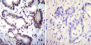 Immunohistochemistry (Formalin/PFA-fixed paraffin-embedded sections) - Anti-NFAT1 antibody [25A10.D6.D2] (AB2722)