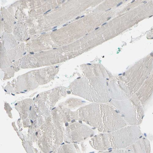 Immunohistochemistry (Formalin/PFA-fixed paraffin-embedded sections) - Anti-NFAT1 antibody (AB244310), expandable thumbnail